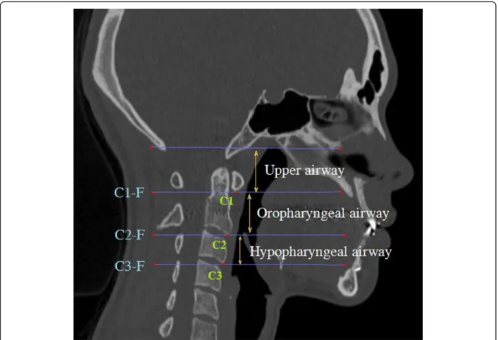 Fig. 3 a. Measurements of preoperative and postoperative airway parameter changes using Invivo 5 superimposition module