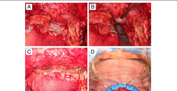 Fig. 4 a Tissue adhesion is observed after superior ophthalmic osteotomy at the upper right of the picture