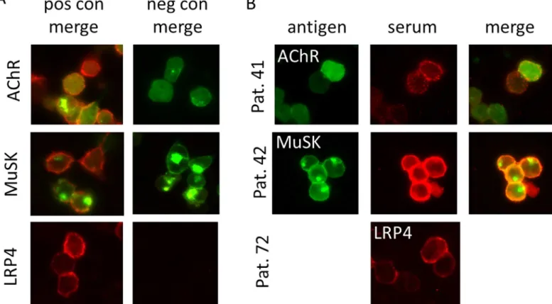 Fig 3. Cell based assays to detect antibodies to clustered AChR, MuSK or LRP4. Patient IgG binding is shown in red