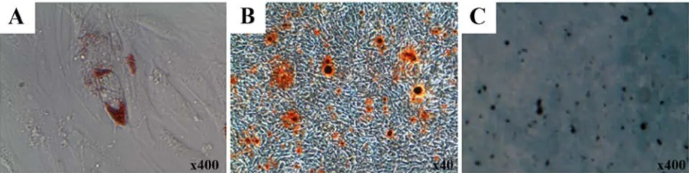 Figure 1. Establishment of the differentiation potential of tonsil-derived mesenchymal stem cells (T-MSCs) toward mesodermal lineages