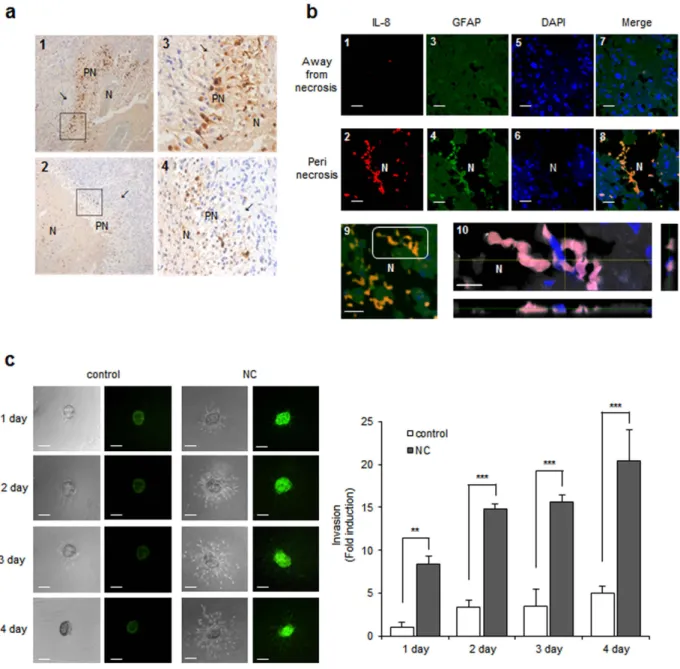 Figure 2.  Necrotic cells induce IL-8 expression and cell invasion. (a) Immunohistochemical-l staining for 