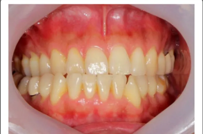 Fig. 3 Proliferation of the left condylar head could be easily checked