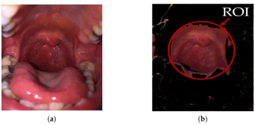 Figure 7. The example output obtained by the image segmentation step of our proposed method