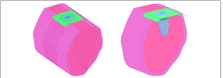 Fig. 4 Class III modifications