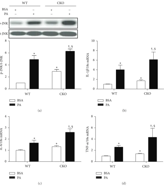 Figure 4: Catalase knockdown increases palmitate-induced inflammation in bone marrow-derived macrophages
