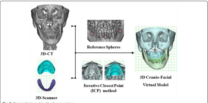Fig. 3 3D craniofacial model with reference spheres