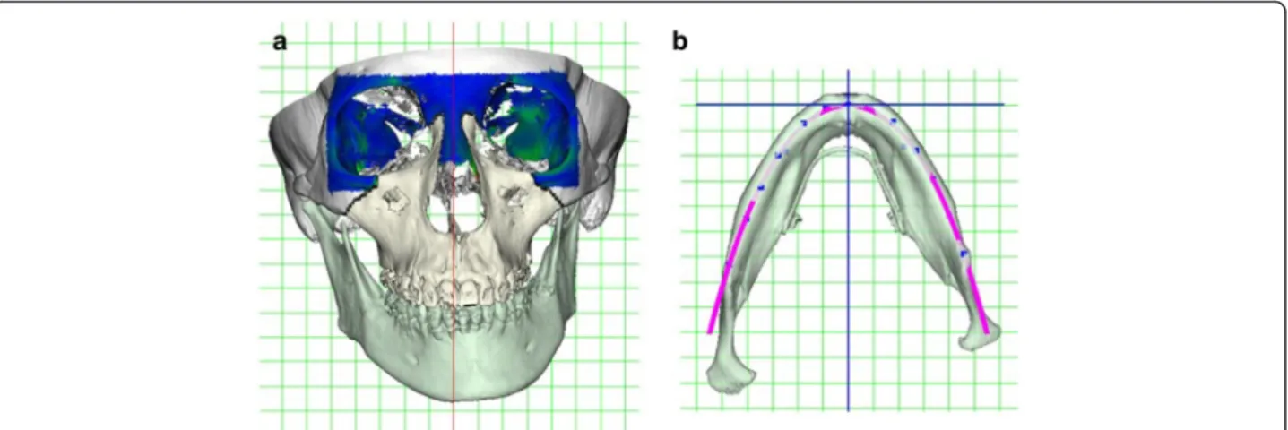Figure 13 shows the treatment progress in the facial and oral photographs. The basic concept of the