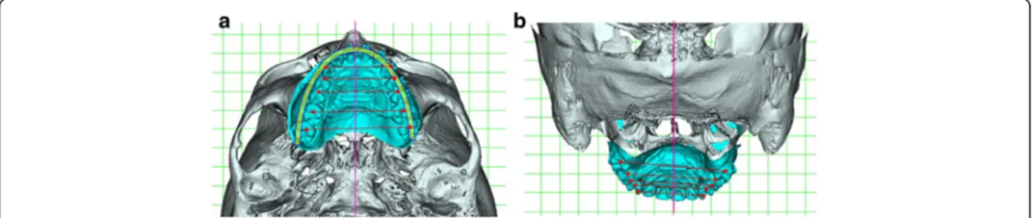 Fig. 10 3D diagnosis in mandibular local coordinates MLB in case 1. a Inferior view. b Superior view