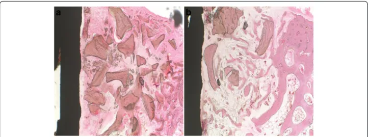 Fig. 3 Histological sections at the second week. a Control group: defects treated with xenograft alone
