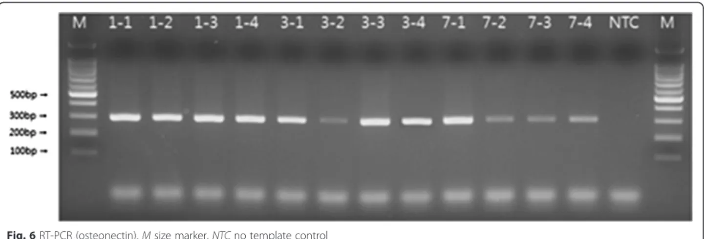 Fig. 6 RT-PCR (osteonectin). M size marker, NTC no template control