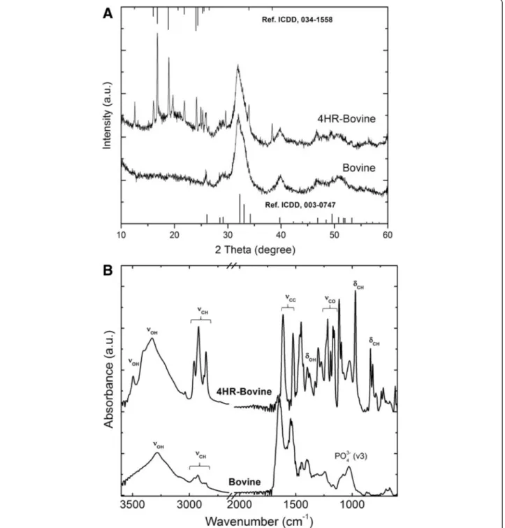 Figure 1a shows the XRD patterns of the bovine and 4HR- 4HR-treated bovine samples. The bovine specimenpresents a typical diffraction pattern corresponding to an HA phase (International Center for Diffraction Data (ICDD), 003-0747), consisting of calcium h