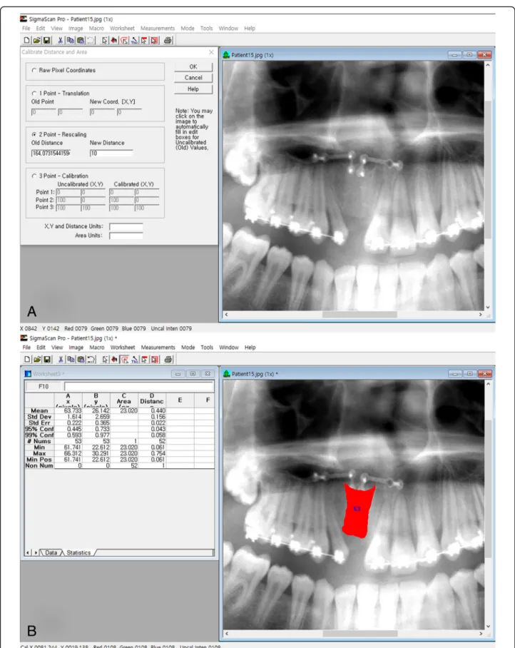 Fig. 2 Measuring the area of the graft bone. a Calibrating with the long axis of the upper central incisor