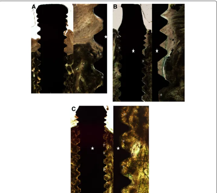 Figure 3 Microphotographs of experimental group. A. Histopathologic findings in 4 weeks, Lt: Low power view showed increased new bone formation (open asterisks) and bone-implant contact(BIC) ratio around the implant (asterisk)
