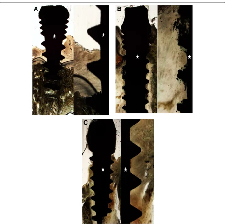 Figure 4 Microphotographs of control group. A. Histopathologic findings in 4 weeks, Lt: Low power view showed little new bone formation (open asterisks) around the implant (asterisk)