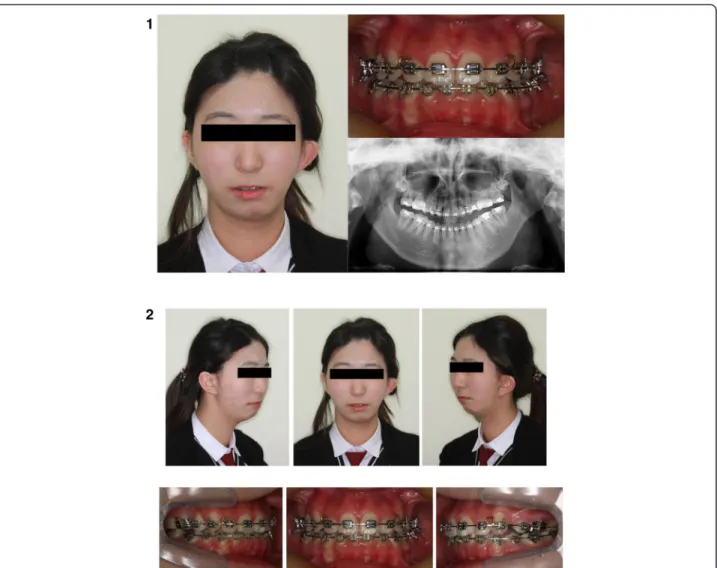 Figure 6 Pre-operative view of patient. 1. Pre-operative photographs and panoramic view