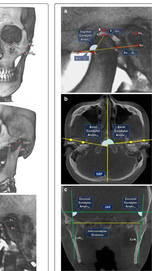 Figure 1 Reference points on 3D reconstruction model.