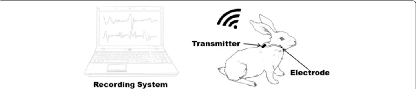 Figure 1 Schematic configuration of the electromyography (EMG) recording system.