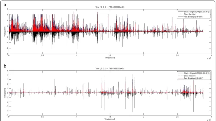 Figure 2 Raw electromyography (EMG) signals from the rabbit masseter muscles. a. EMG signals before BTX-A injection