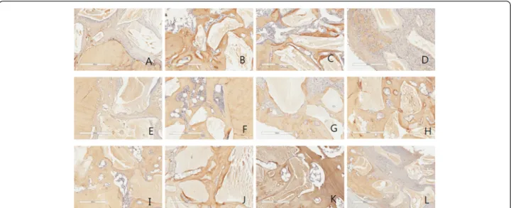Fig. 4 Collagen type I antibody reaction of grafted sites. a 2 week group 1; b 2week group 2; c 2week group 3; d 2 week group 4; e 4 week group 1; f 4 week group 2; g 4 week group 3; h 4 week group 4; i 8 week group 1; j 8 week group 2; k 8 week group 3; l