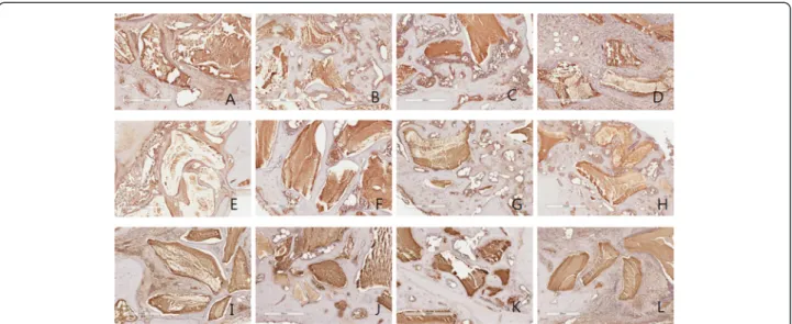 Fig. 5 OPG antibody reaction of grafted sites. a 2 week group 1; b 2week group 2; c 2week group 3; d 2 week group 4; e 4 week group 1; f 4 week group 2; g 4 week group 3; h 4 week group 4; i 8 week group 1; j 8 week group 2; k 8 week group 3; l 8 week grou
