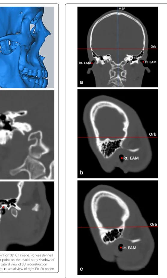 Fig. 1 Determination of Po point on 3D CT image. Po was defined as the most superior and outer point on the ovoid bony shadow of the external auditory meatus