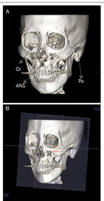 Fig. 1 Anatomical landmarks and reference planes in 3D-CT: a reference points and b reference planes