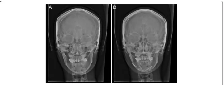 Fig. 6 Radiographic findings of case 2: a pre-operation and b post-operation