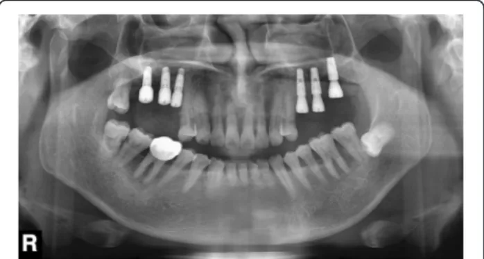 Fig. 8 Panoramic images taken 1 year and 5 months after surgery, confirming significant reduction of bone resorption patterns in left condyle