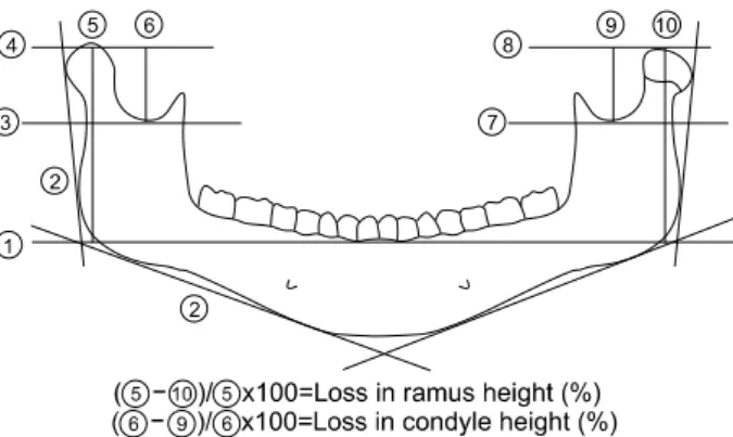Fig. 2. Distances in the panoramic radiogram according to  Hlawitschka and Eckelt[23]