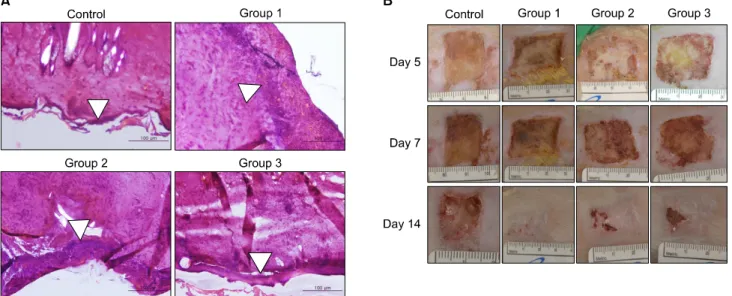 Fig. 3. (A) Histology (H&amp;E, ×400) of each group. Group 1 and 2 and 3 show more re-epithelialization than the control group