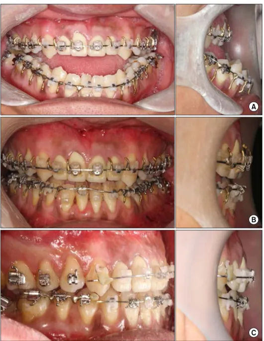 Fig. 3. (A) Preoperative photograph.