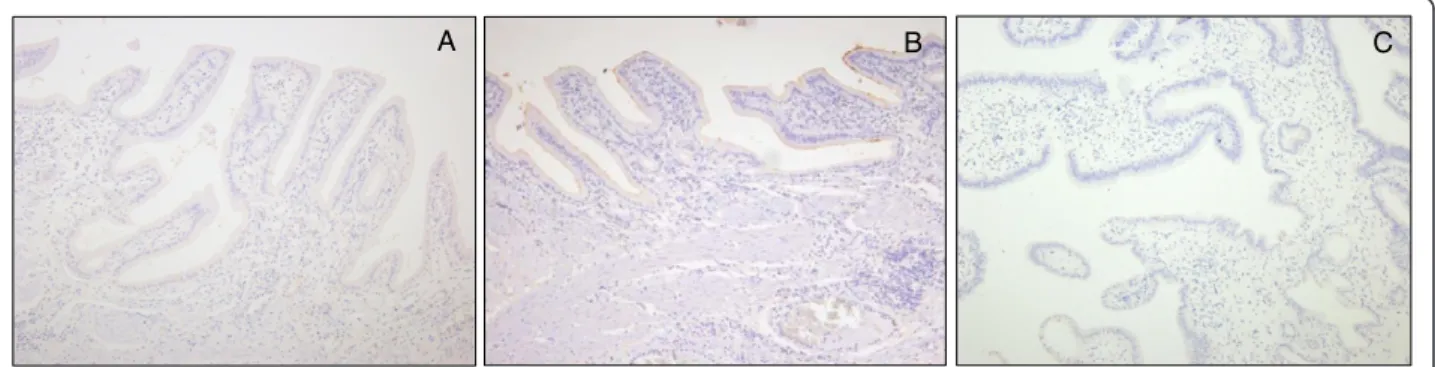 Figure 1 Immunohistochemical staining of MUC4 (A), MUC1 (B), and MUC2(C) in normal gallbladder mucosa