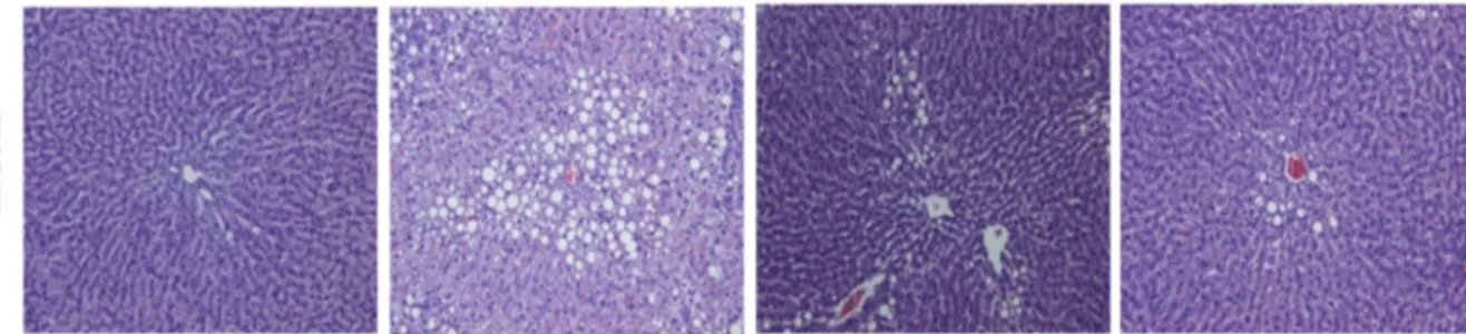 Figure 3. Confirmation of hepatic fatty liver in rats fed alcohol and KRG for 6 weeks