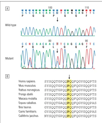 Figure 4. Sequencing chromatograms and conservation analysis of c.854C ⬎T (Pro285Leu) in TFG