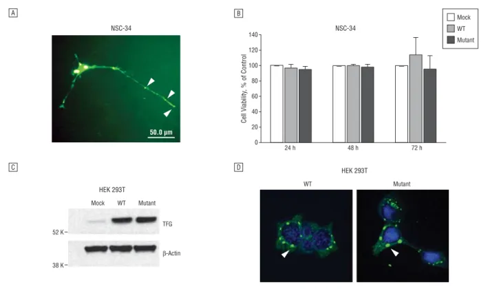 Figure 5. In vitro expression of TFG in NSC-34 and HEK 293T cells. A, NSC-34 cells were transfected with green fluorescent protein (GFP)–tagged wild-type (WT)