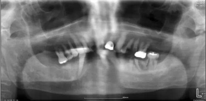 Fig. 1. Dental panoramic view.
