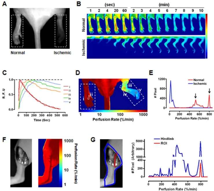 Figure 1. Quantitative measurement of perfusion rate based on spatiotemporal ICG dynamics