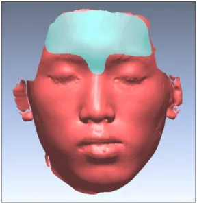 Fig. 1. Reference area for superimposition of three-dimensional facial images.