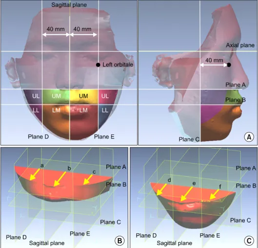 Fig. 5. Three-dimensional (3D)  geometries of the lower facial third.