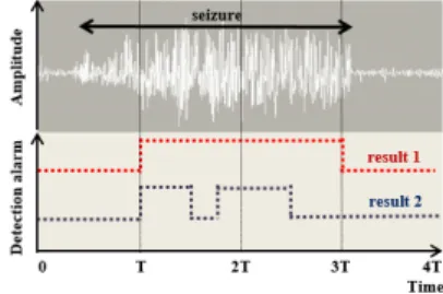Figure A1. Examples of different detection results during a seizure.  References 