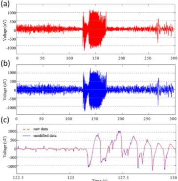Figure 11. Example explaining the effects of supply voltage variations by using a seizure segment