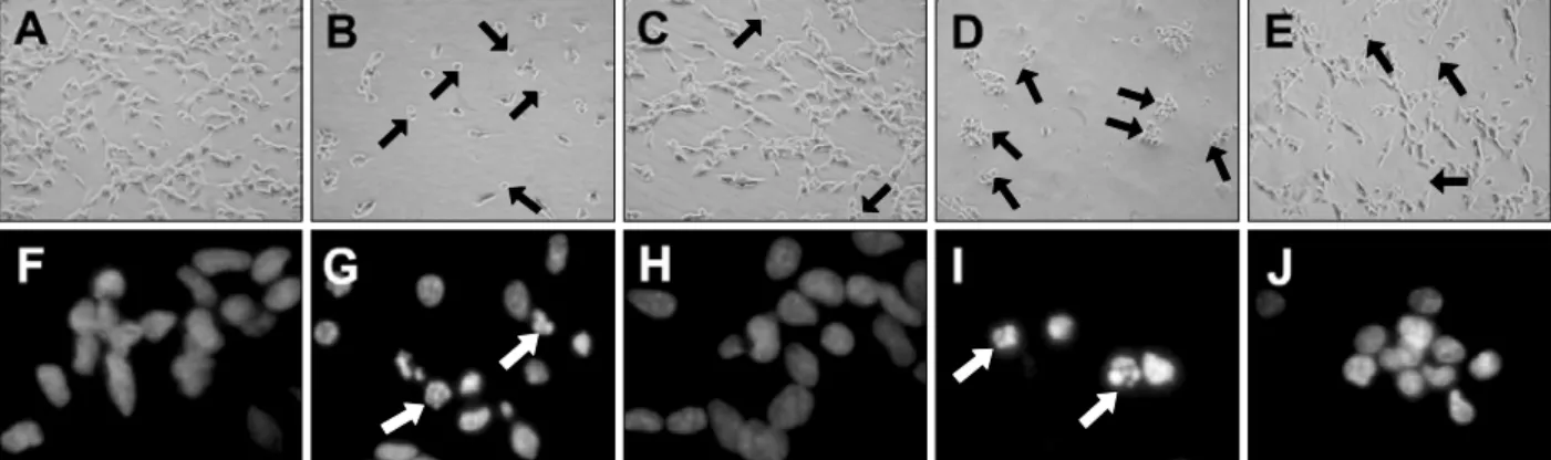 Figure 2. Microscopic analysis of resveratrol on DA-induced cell death. The figures show the phase-contrast photographs of SH-SY5Y cells after DA  treatment in the absence or presence of resveratrol