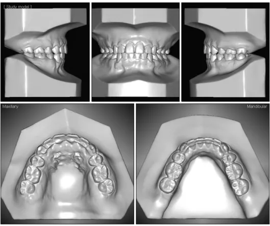 Fig. 9. Ten-month posttreatment  dental casts. 