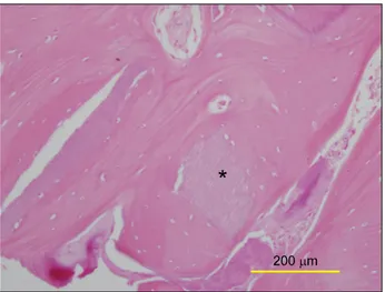 Fig. 6. Optical microscopic view (H&amp;E stain, ×100). Newly formed bone is identified around autogenous tooth bone graft material.