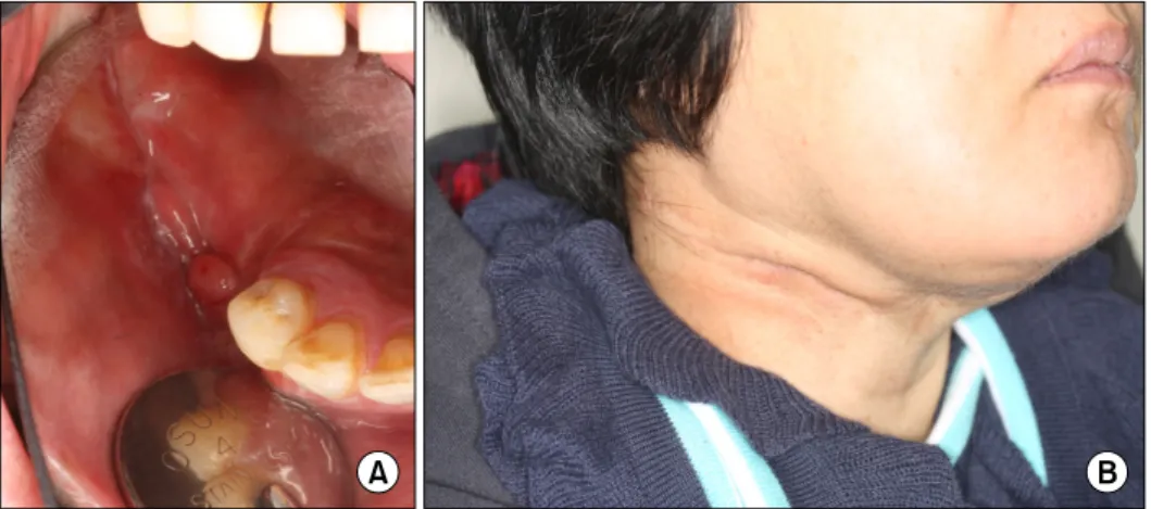 Fig. 9. (A) Intraoral clinical photo in the postoperative follow-up period  (3 months)