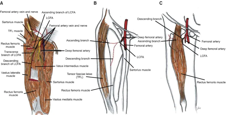 Fig. 2. (A) Schematic drawings of lateral circumflex femoral artery (LCFA) and its branches, femoral nerves and its related muscular anatomies, and (B) tensor fascie latae musculocutaneous flap, and (C) rectus femoris myocutaneous flap.