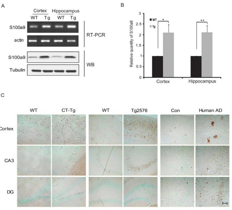 Figure 1. S100a9 was induced in the brains of CT-Tg, Tg2576 mice and Human AD patients