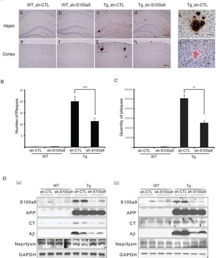Figure 5. S100a9 knockdown reduced the number of amyloid plaques in Tg2576 mouse brains