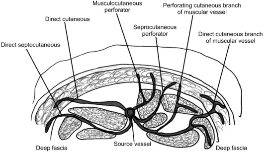 Fig. 4. Clinical view of two perforators (arrows) in the septofascio- septofascio-cutaneous ALT flap