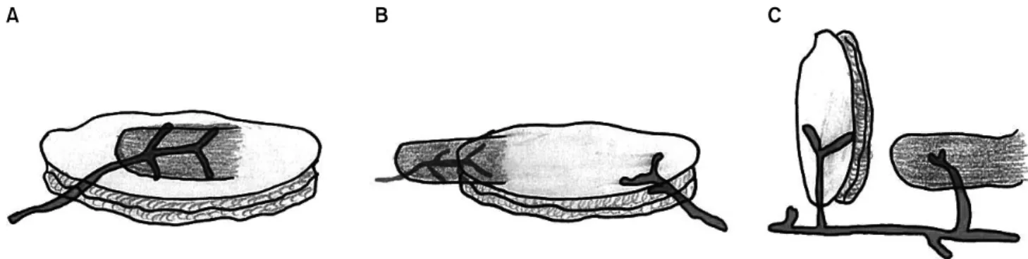 Fig. 5. Schematic drawings of perforators to the skin territories based on their primary source of vascularization